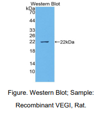 https://msimg.bioon.com/bionline/goods-no-pic.png