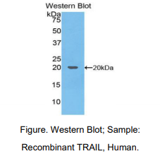 https://msimg.bioon.com/bionline/goods-no-pic.png