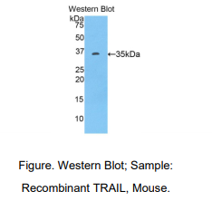 https://msimg.bioon.com/bionline/goods-no-pic.png