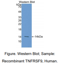 https://msimg.bioon.com/bionline/goods-no-pic.png