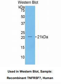 https://msimg.bioon.com/bionline/goods-no-pic.png