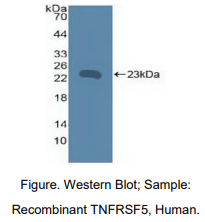 https://msimg.bioon.com/bionline/goods-no-pic.png