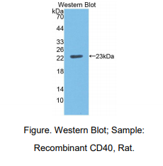 https://msimg.bioon.com/bionline/goods-no-pic.png