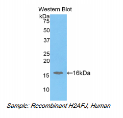 https://msimg.bioon.com/bionline/goods-no-pic.png