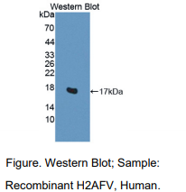 https://msimg.bioon.com/bionline/goods-no-pic.png