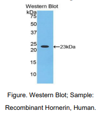 人Hornerin蛋白(HRNR)多克隆抗体