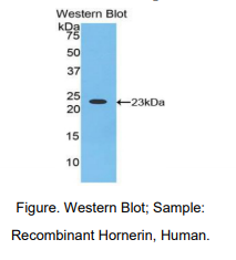 https://msimg.bioon.com/bionline/goods-no-pic.png