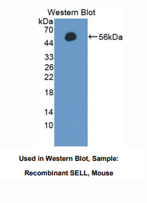 https://msimg.bioon.com/bionline/goods-no-pic.png