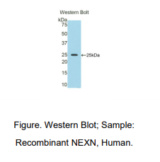 人Nexn结合蛋白(NEXN)多克隆抗体