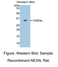 https://msimg.bioon.com/bionline/goods-no-pic.png