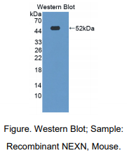 https://msimg.bioon.com/bionline/goods-no-pic.png