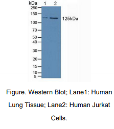 https://msimg.bioon.com/bionline/goods-no-pic.png