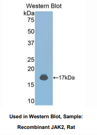 大鼠Janus激酶2(JAK2)多克隆抗体