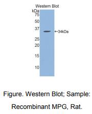 https://msimg.bioon.com/bionline/goods-no-pic.png