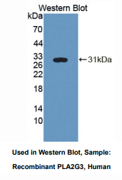 https://msimg.bioon.com/bionline/goods-no-pic.png