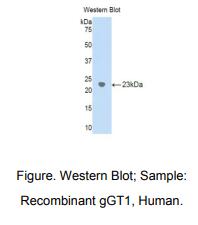 人γ-谷氨酰转移酶1(gGT1)多克隆抗体