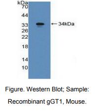 https://msimg.bioon.com/bionline/goods-no-pic.png