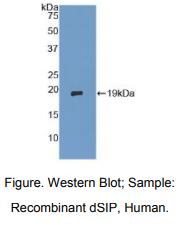 https://msimg.bioon.com/bionline/goods-no-pic.png