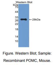 https://msimg.bioon.com/bionline/goods-no-pic.png