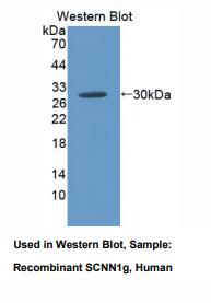 人阿米洛利敏感钠离子通道蛋白1γ(SCNN1g)多克隆抗体