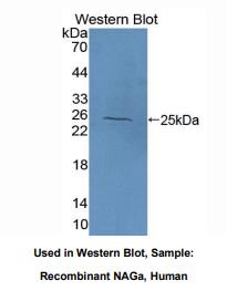 https://msimg.bioon.com/bionline/goods-no-pic.png