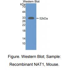 https://msimg.bioon.com/bionline/goods-no-pic.png