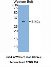 https://msimg.bioon.com/bionline/goods-no-pic.png