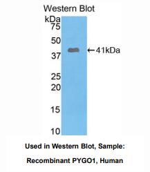 https://msimg.bioon.com/bionline/goods-no-pic.png