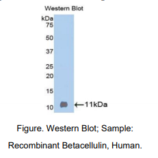 https://msimg.bioon.com/bionline/goods-no-pic.png