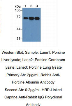 https://msimg.bioon.com/bionline/goods-no-pic.png