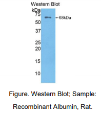 https://msimg.bioon.com/bionline/goods-no-pic.png