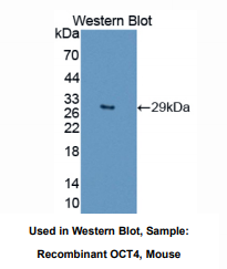 https://msimg.bioon.com/bionline/goods-no-pic.png