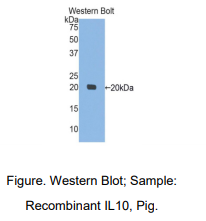 https://msimg.bioon.com/bionline/goods-no-pic.png