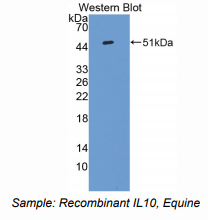 https://msimg.bioon.com/bionline/goods-no-pic.png