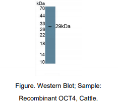 https://msimg.bioon.com/bionline/goods-no-pic.png