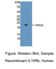 https://msimg.bioon.com/bionline/goods-no-pic.png