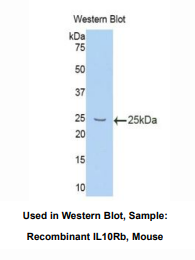 https://msimg.bioon.com/bionline/goods-no-pic.png