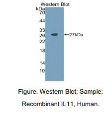 人白介素11(IL11)多克隆抗体
