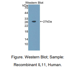 https://msimg.bioon.com/bionline/goods-no-pic.png