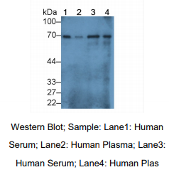 https://msimg.bioon.com/bionline/goods-no-pic.png