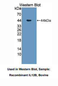 https://msimg.bioon.com/bionline/goods-no-pic.png