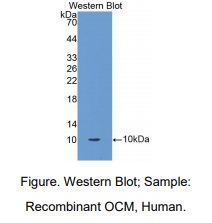 人癌调蛋白(OCM)多克隆抗体