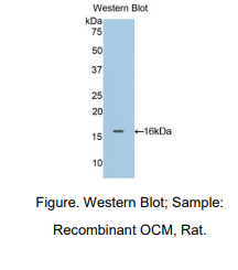 https://msimg.bioon.com/bionline/goods-no-pic.png