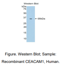 https://msimg.bioon.com/bionline/goods-no-pic.png