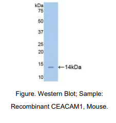 https://msimg.bioon.com/bionline/goods-no-pic.png