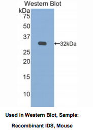 小鼠艾杜糖-2-硫酸酯酶(IDS)多克隆抗体