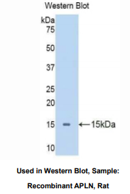 大鼠爱帕琳肽(APLN)多克隆抗体