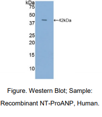 人氨基端前心钠肽(NT-ProANP)多克隆抗体