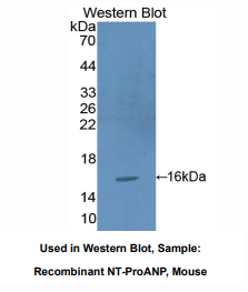 https://msimg.bioon.com/bionline/goods-no-pic.png