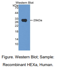 人氨基己糖苷酶Aα(HEXa)多克隆抗体